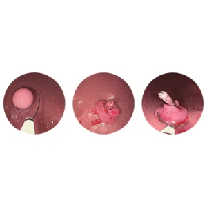 Esophago-Gastro-Duodenoscopy (EGD) Simulator