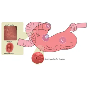 Esophago-Gastro-Duodenoscopy (EGD) Simulator