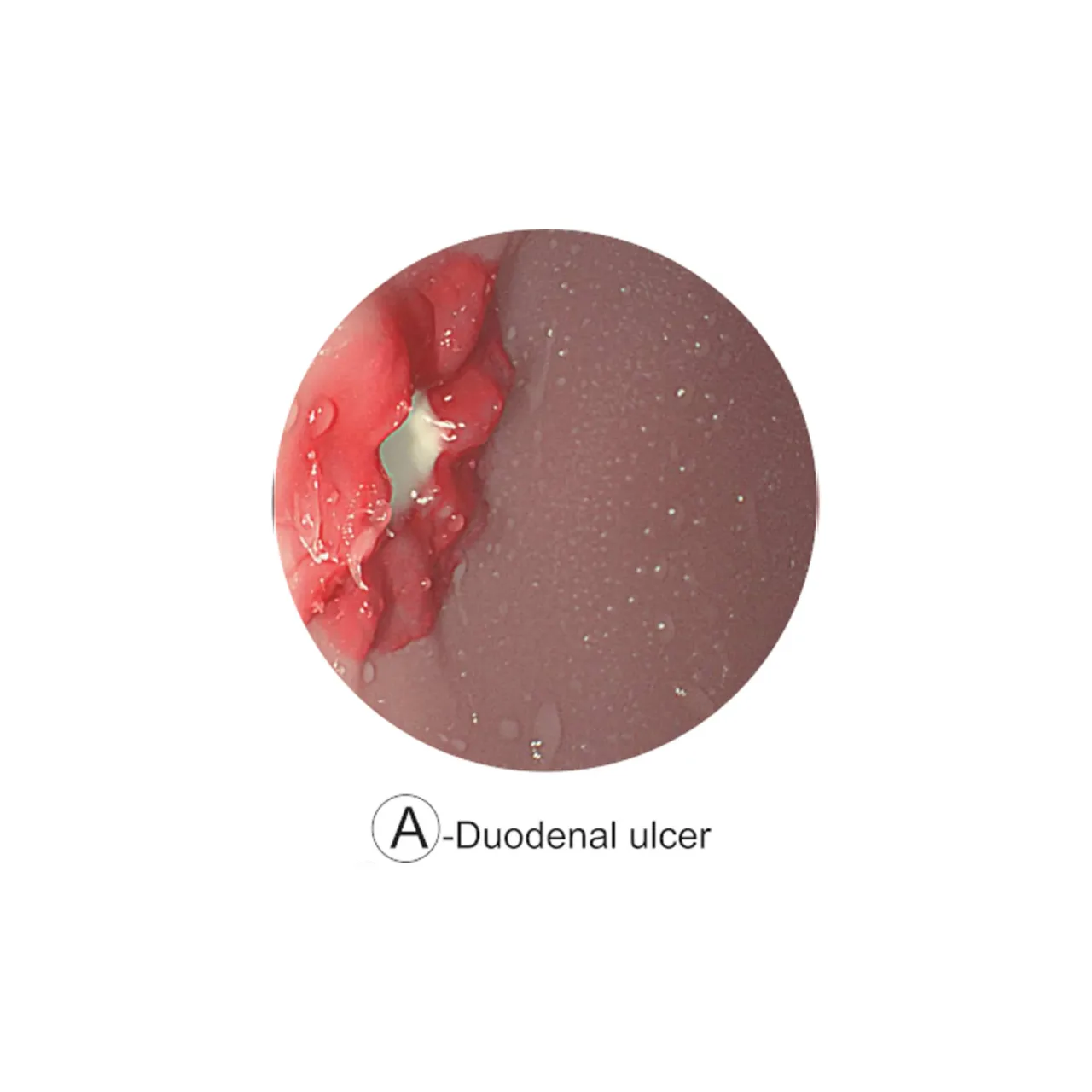 Esophago-Gastro-Duodenoscopy (EGD) Simulator