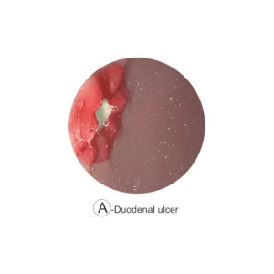 Esophago-Gastro-Duodenoscopy (EGD) Simulator