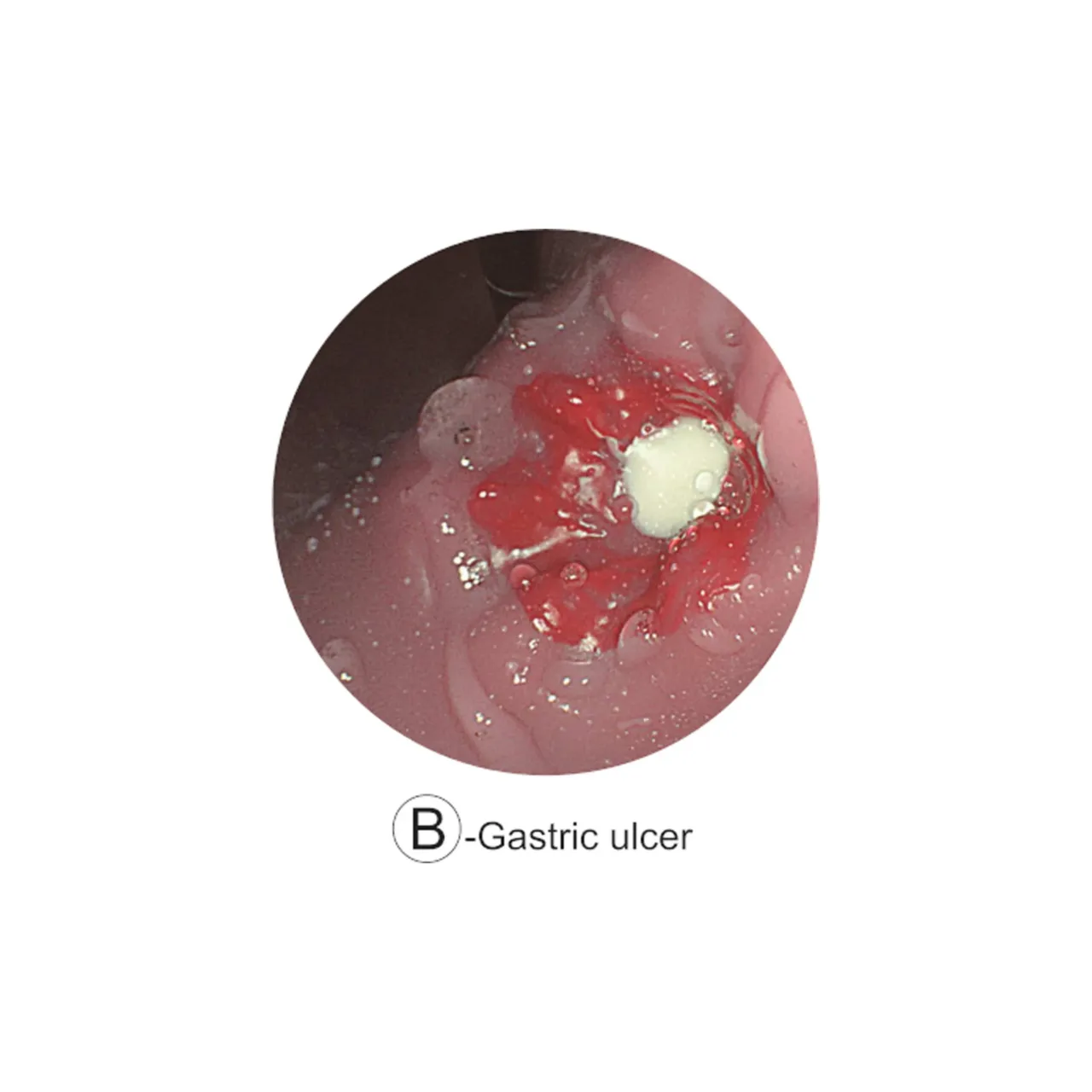 Esophago-Gastro-Duodenoscopy (EGD) Simulator