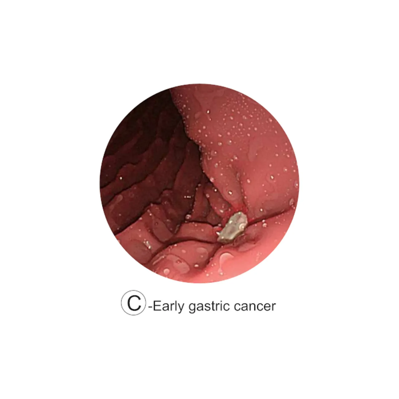 Esophago-Gastro-Duodenoscopy (EGD) Simulator