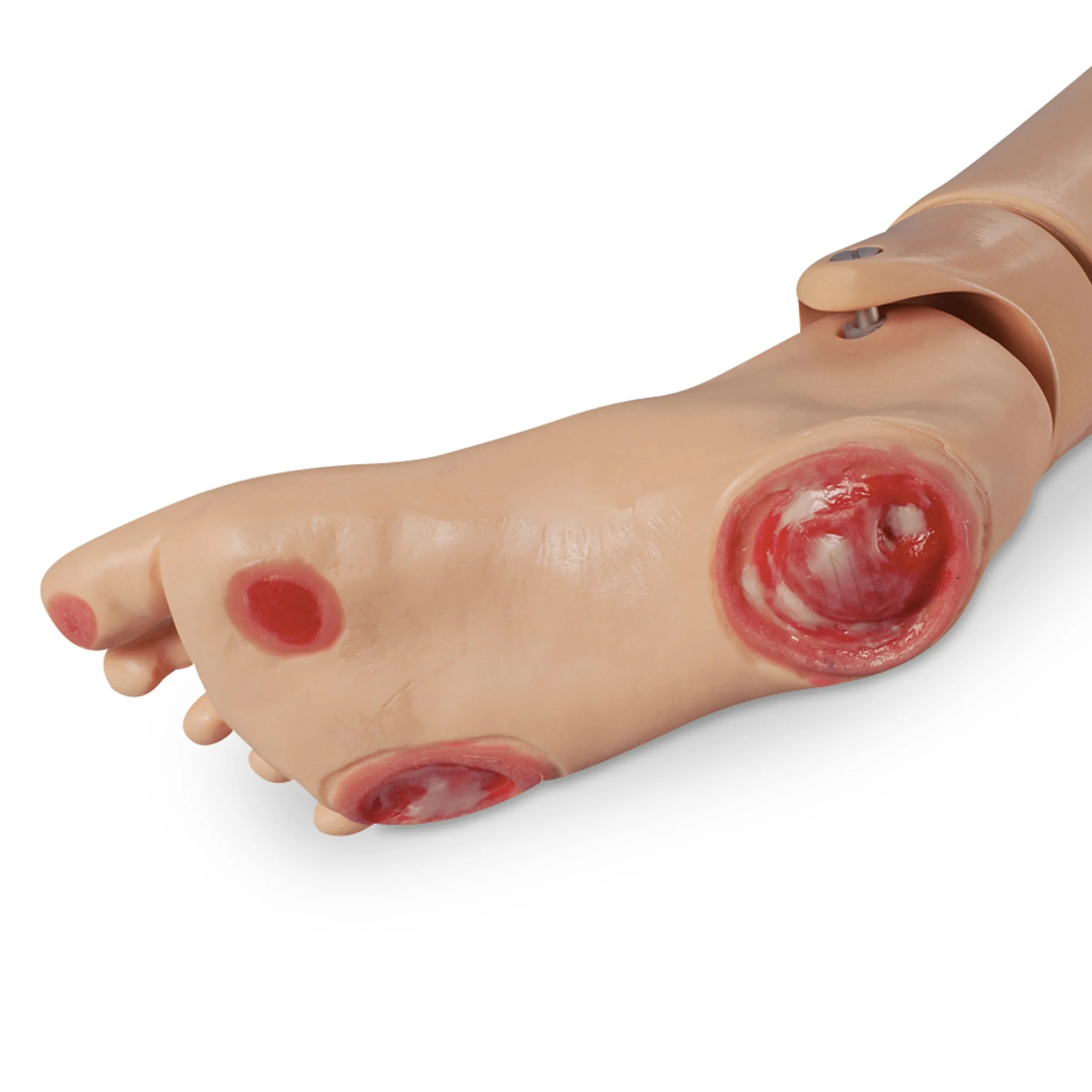 GERi/KERi Optional Pressure Injury Foot, Light