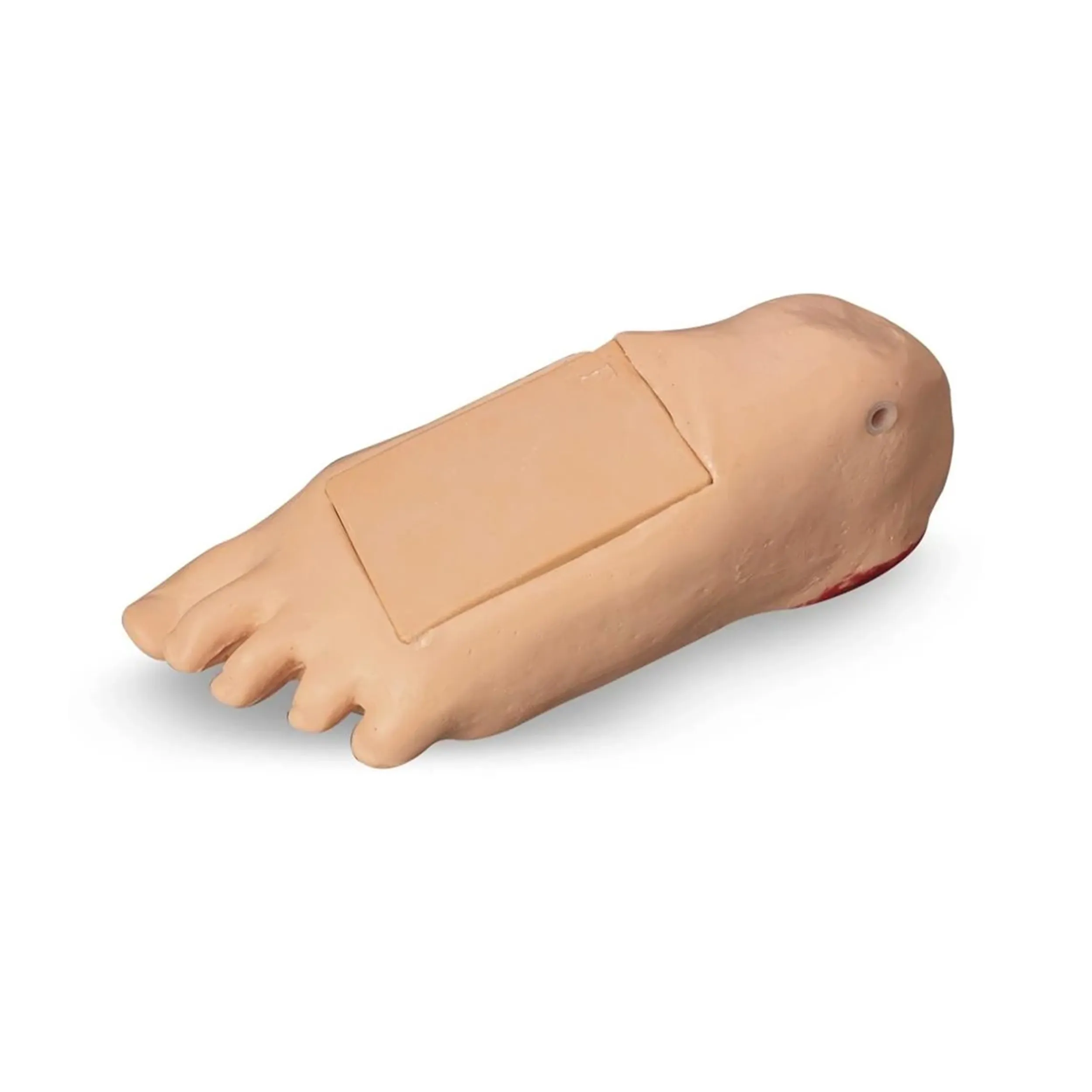 GERi/KERi Optional Edema Foot With Deep Tissue Injury, Light