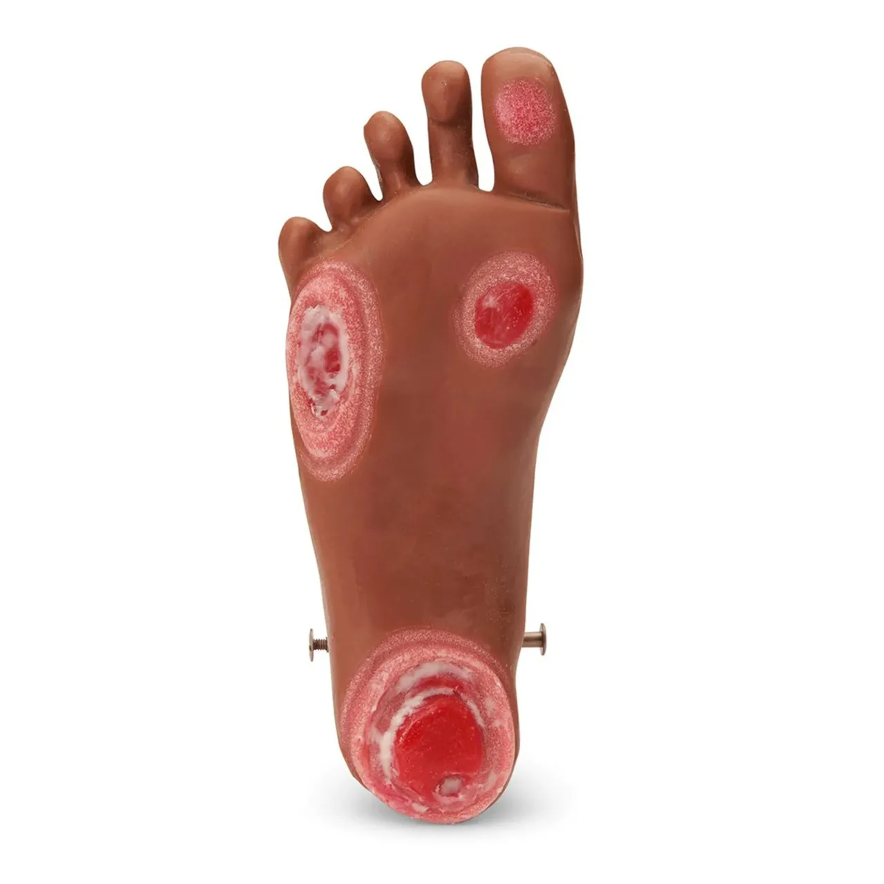 GERi/KERi Optional Pressure Injury Foot, Medium