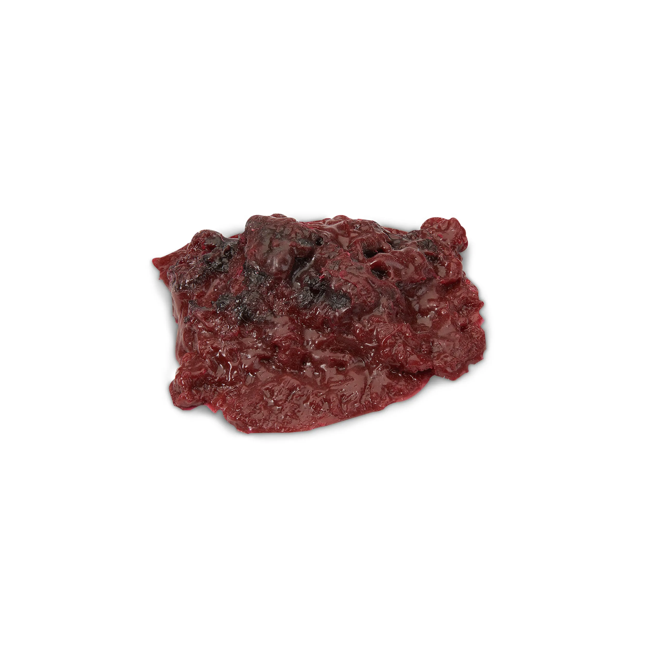 Small Blood Clot