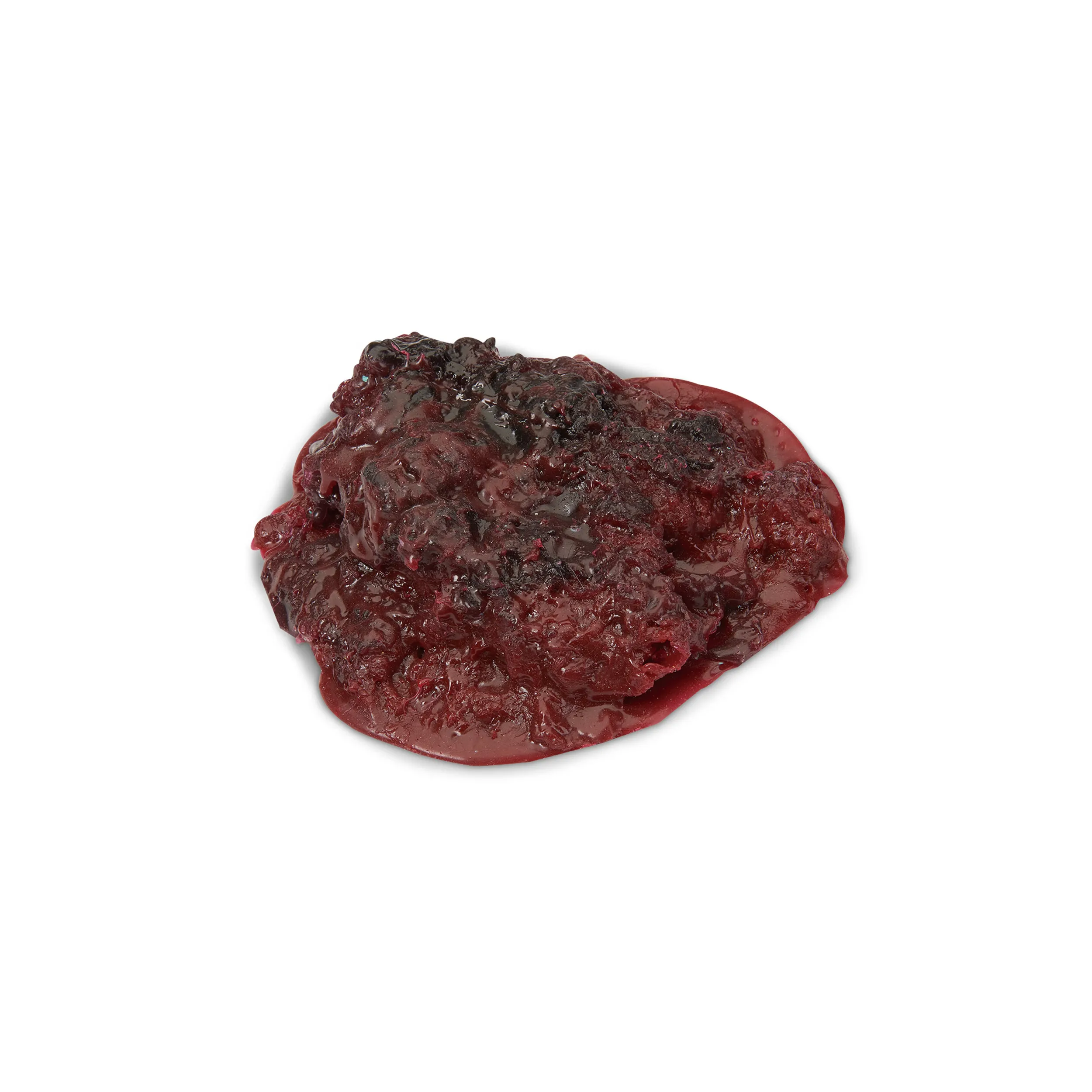 Large Blood Clot