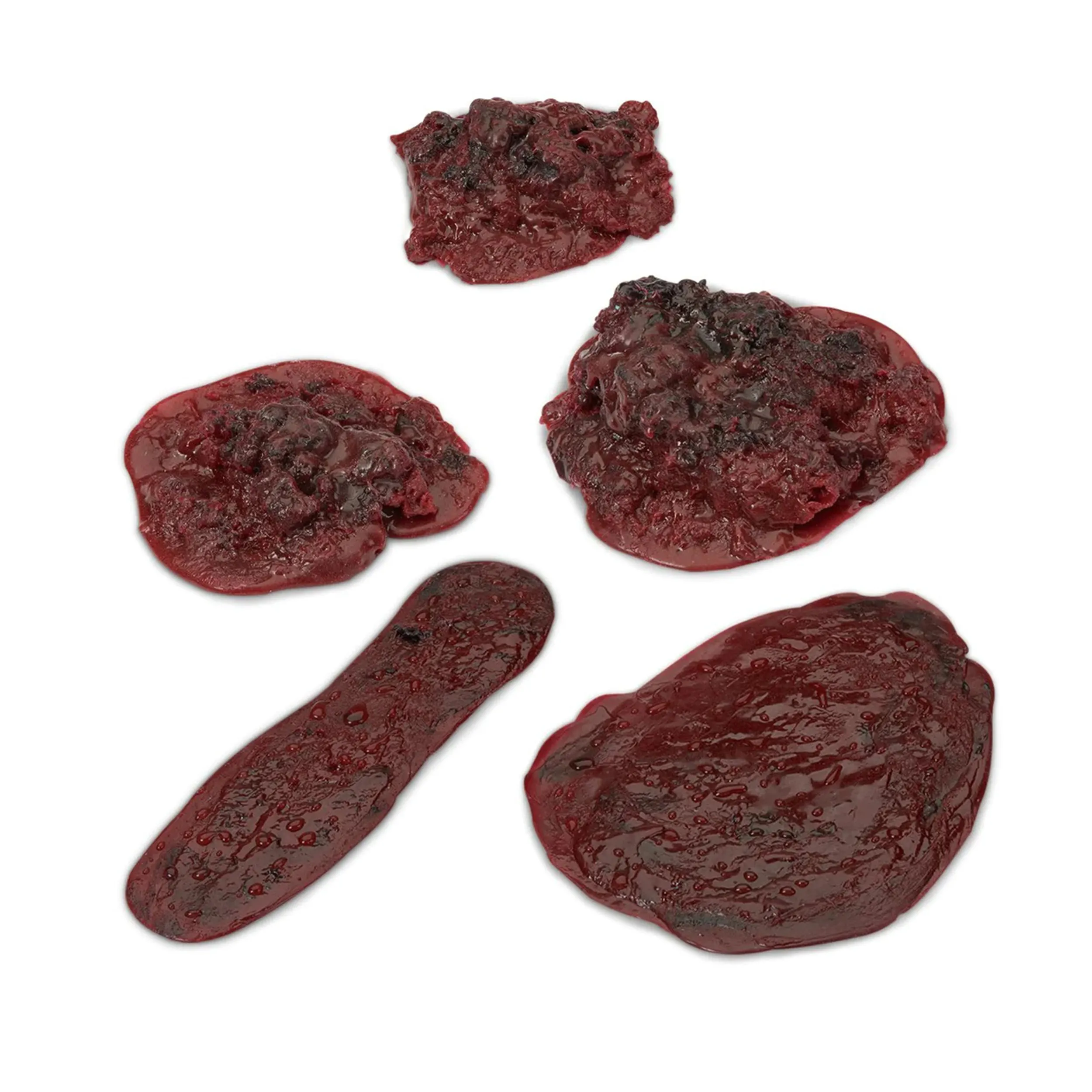 Clots and Haemorrhage Complete Set