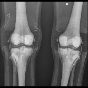 X-Ray/Radiographic Positioning Doll