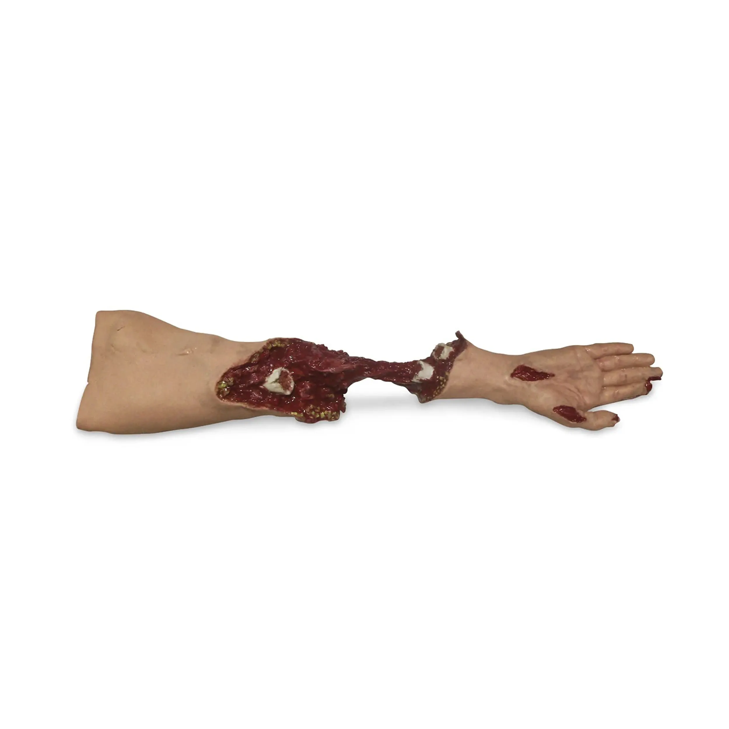 Xtreme Trauma Moulage Arm