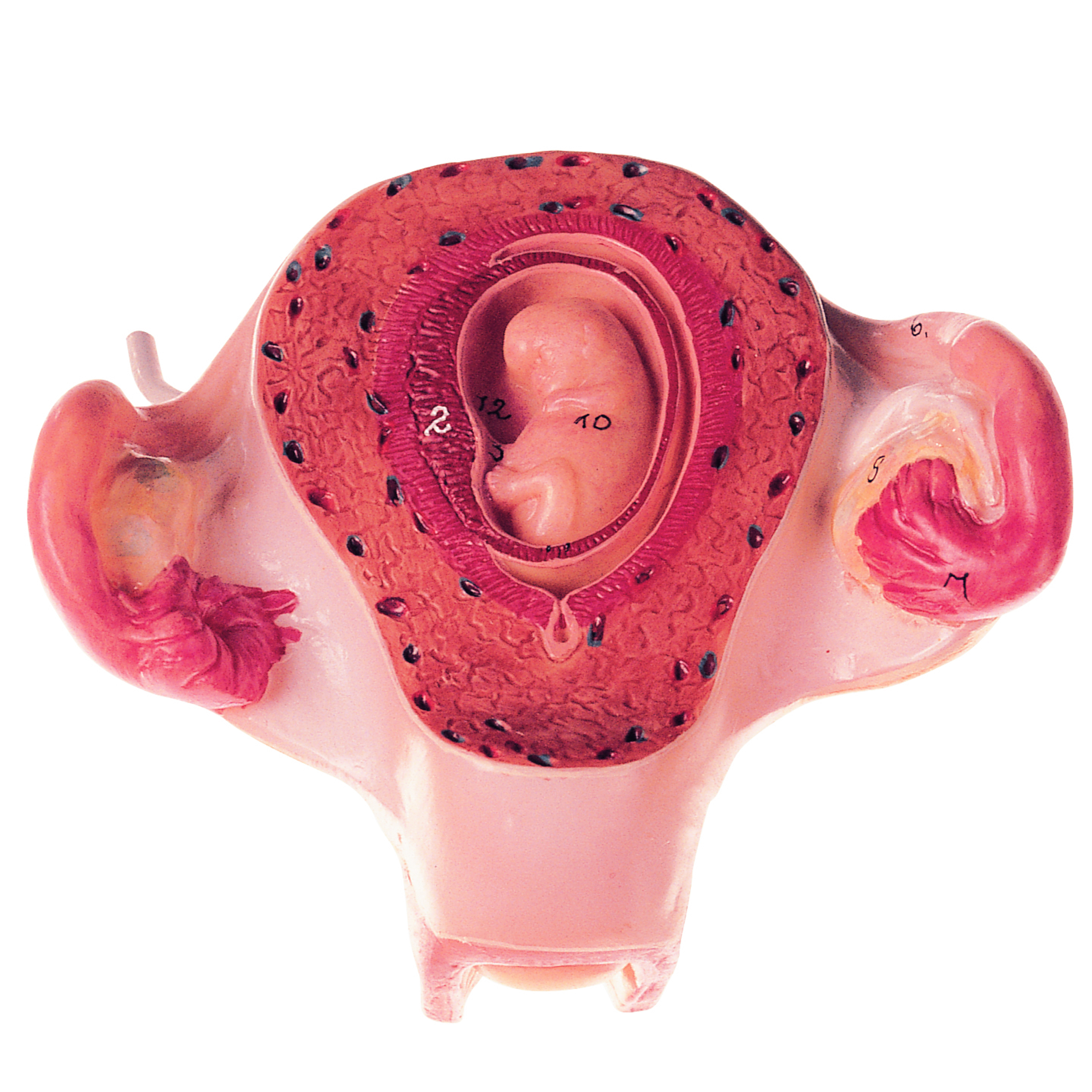 Uterus With Embryo in Second Month