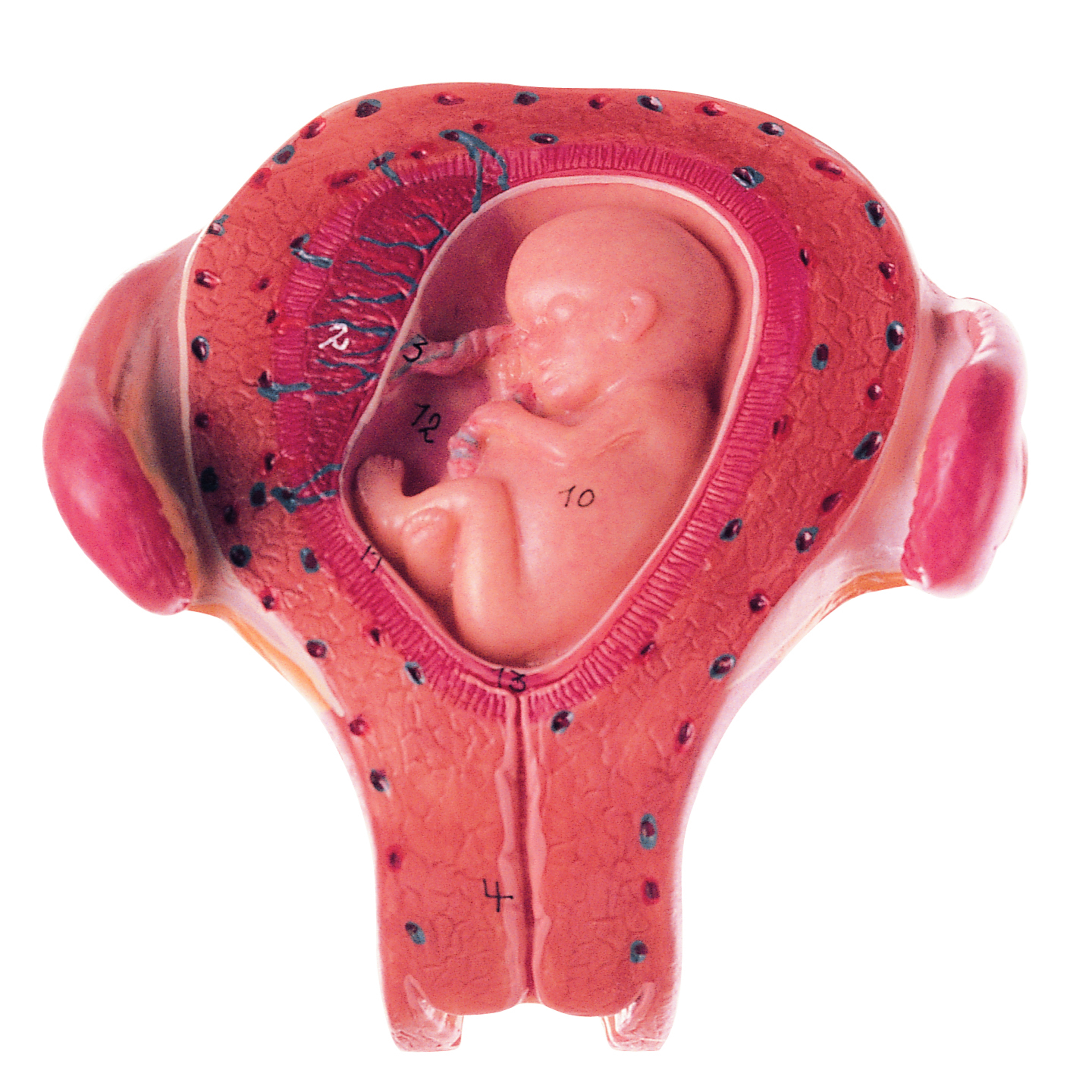 Uterus With Embryo in Third Month