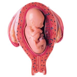Uterus With Fetus in Fifth Month