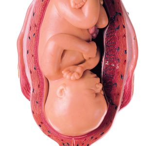 Uterus With Fetus in Seventh Month