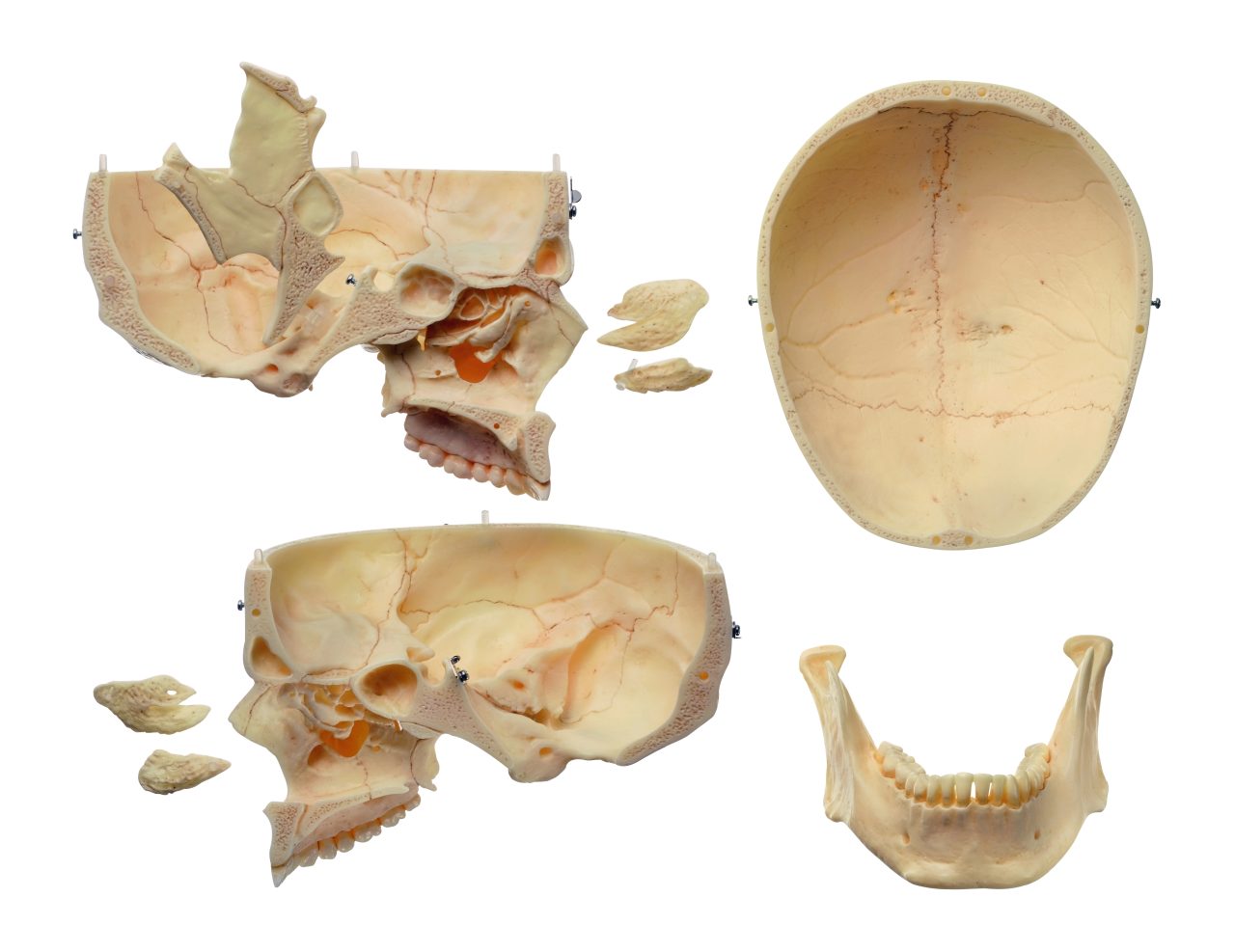 Artificial Human Skull (Separates Into 9 Parts)