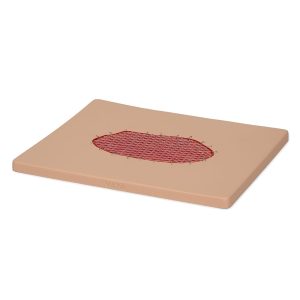 Skin Graft Wound Board, Light