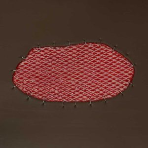 Skin Graft Wound Board, Dark