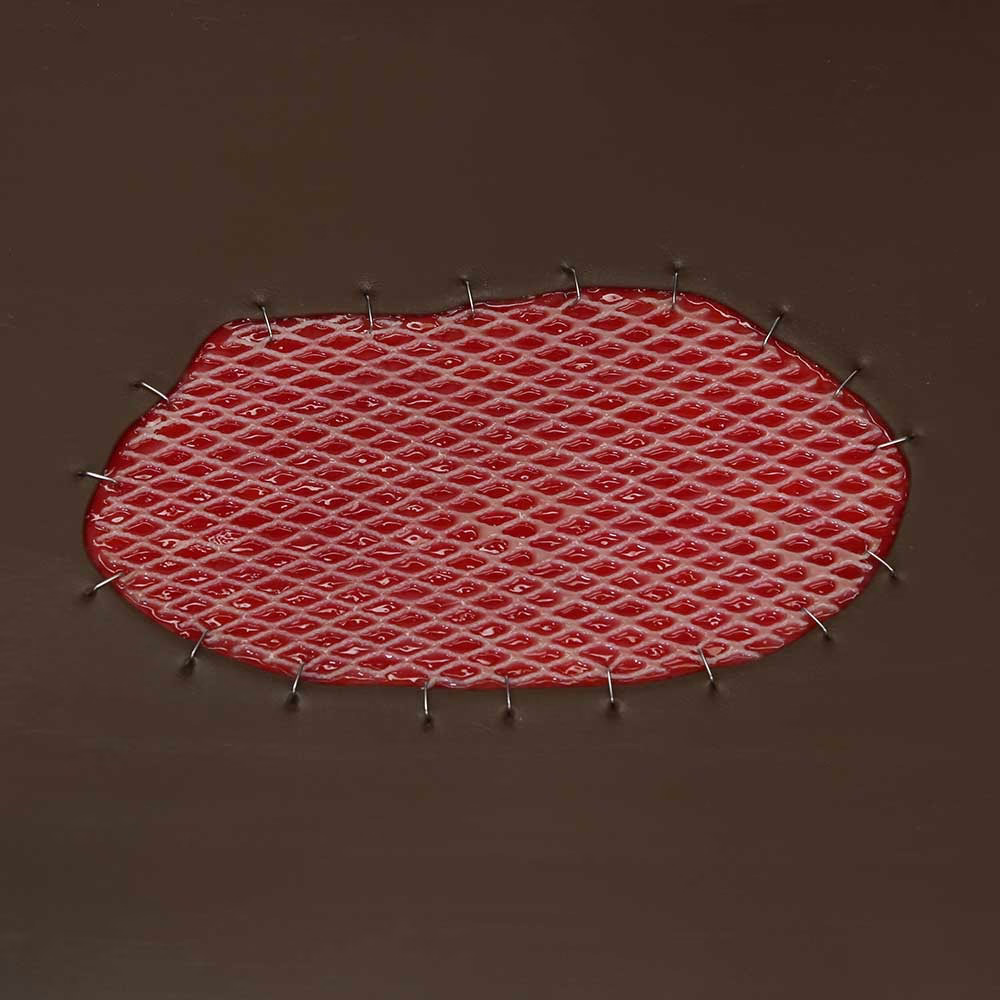 Skin Graft Wound Board, Dark