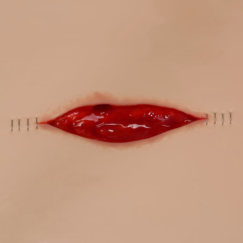 Dehisced Wound Board, Light
