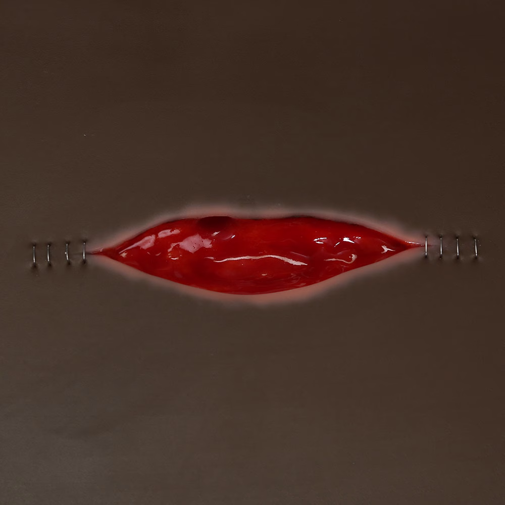 Dehisced Wound Board, Dark