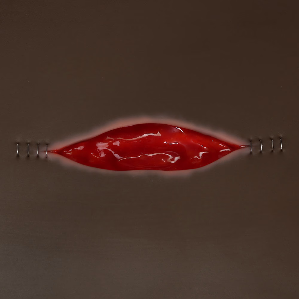 Dehisced Wound Board, Dark