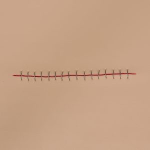 Stapled Incision Wound Board, Light