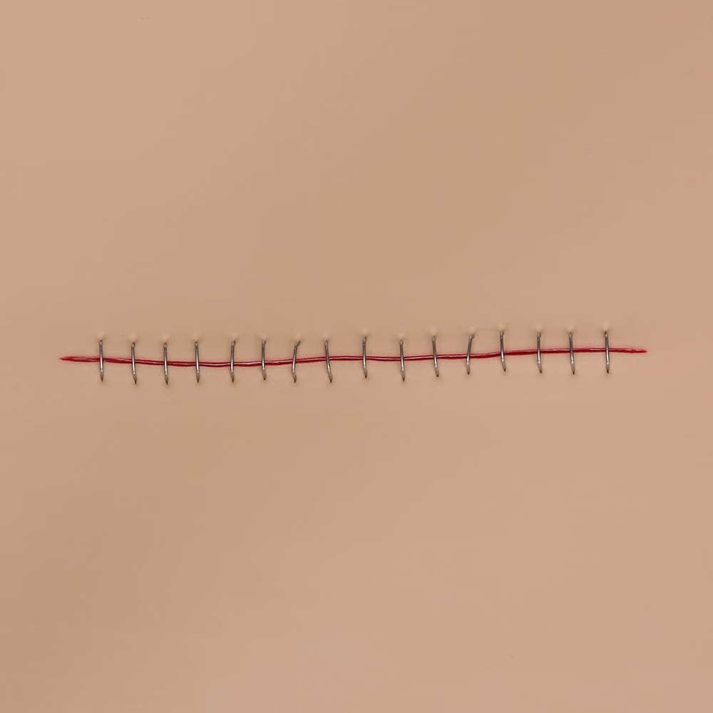 Stapled Incision Wound Board, Light