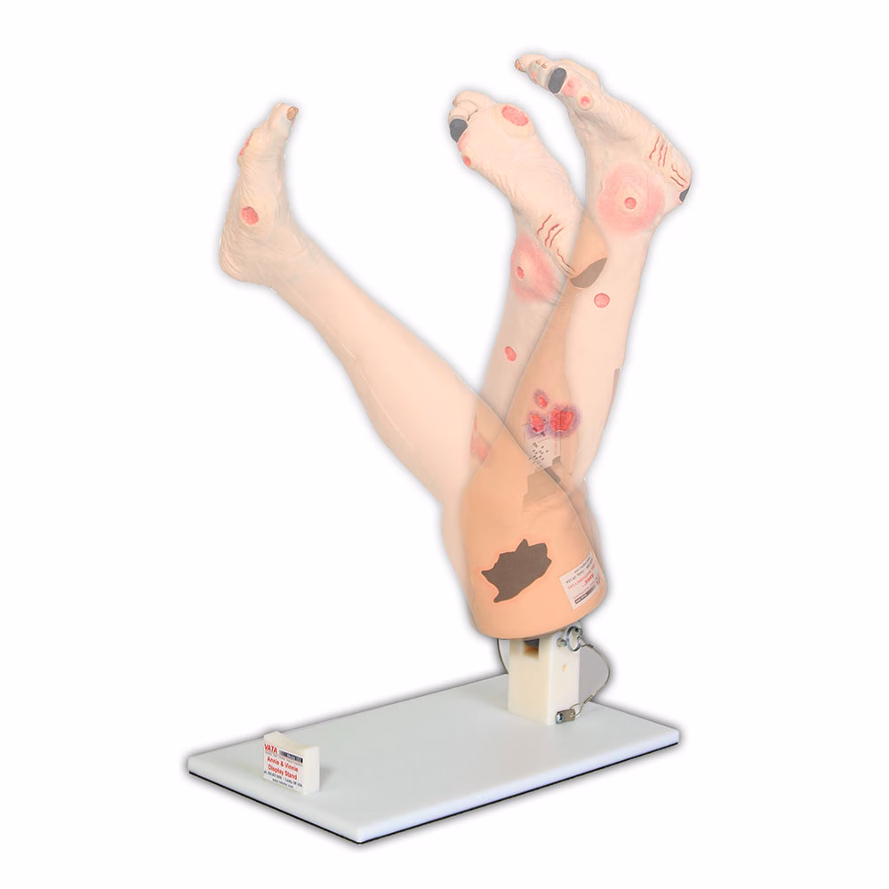 Display Stand For Vinnie or Annie Insufficiency Leg