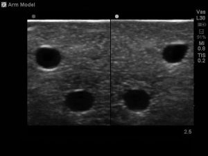 Peripheral Doppler Ultrasound Training Model Package