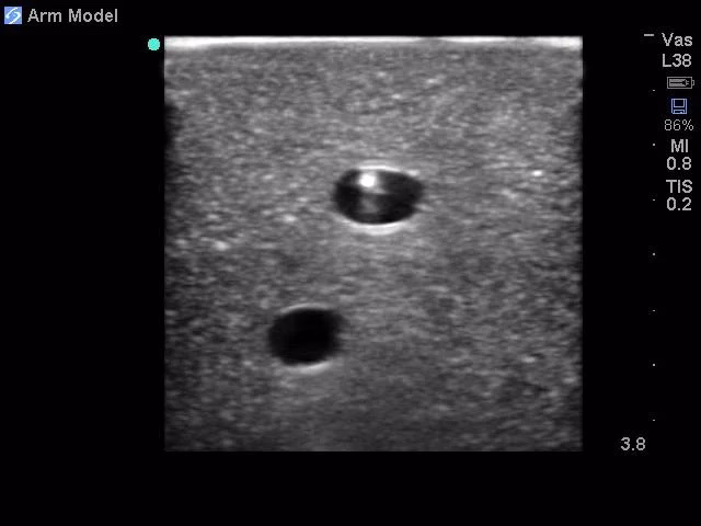 Peripheral Doppler Ultrasound Training Model Package