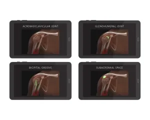Shoulder Injection Trainer Palpation Guided without Tablet, Dark