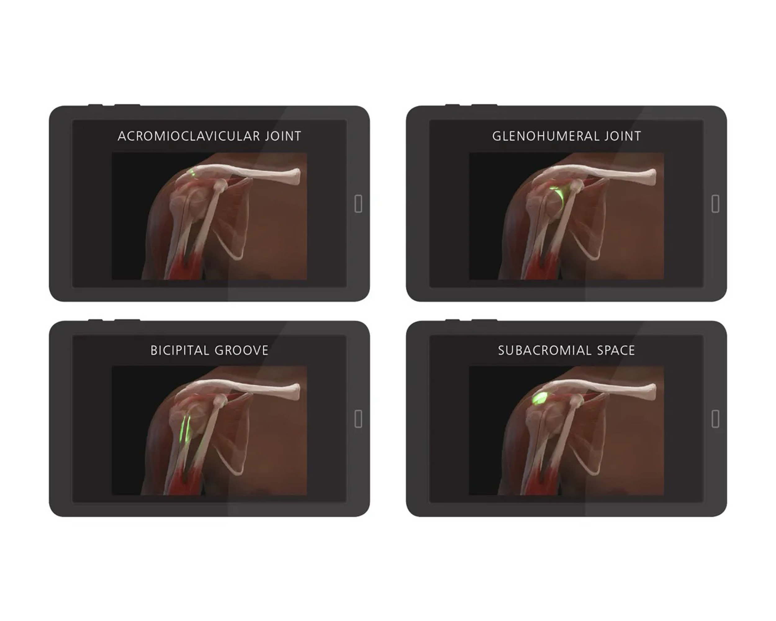 Shoulder Injection Trainer Palpation Guided without Tablet, Dark