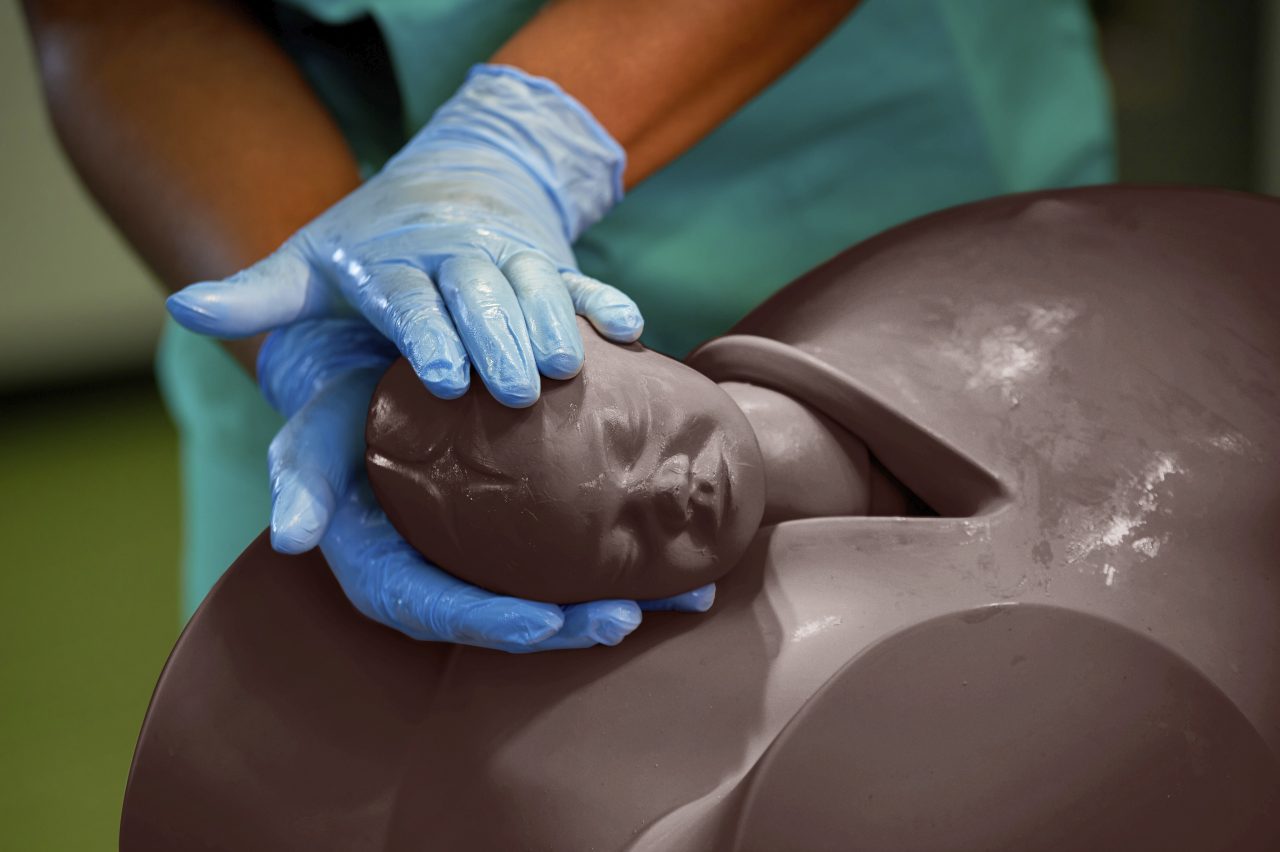 Debra Enhanced® - Impacted Fetal Head Simulator, Dark