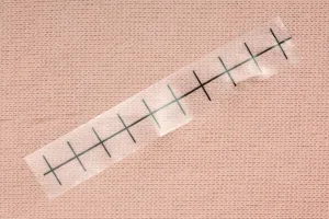 Postoperative Care Suit, Light