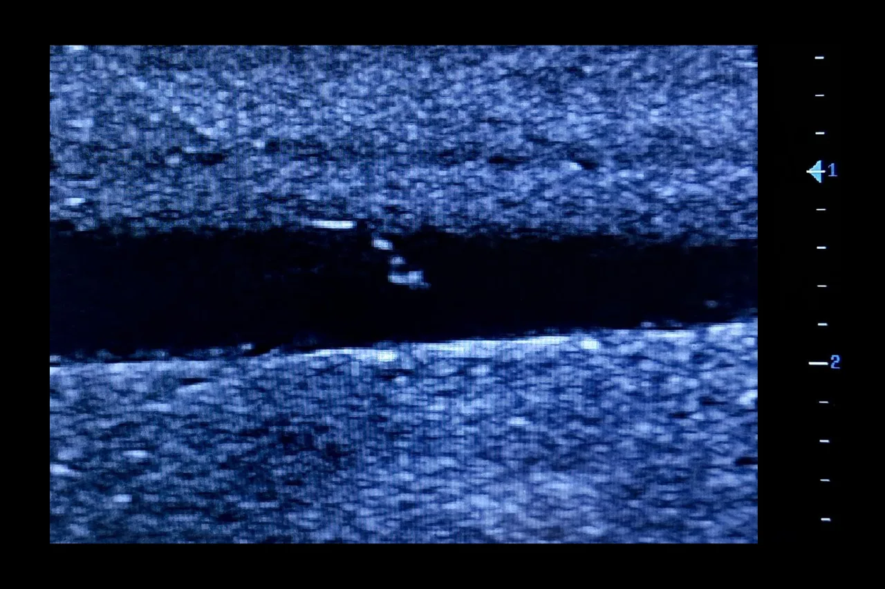 Ultrasound Simulator for Seldinger Technique, Dark