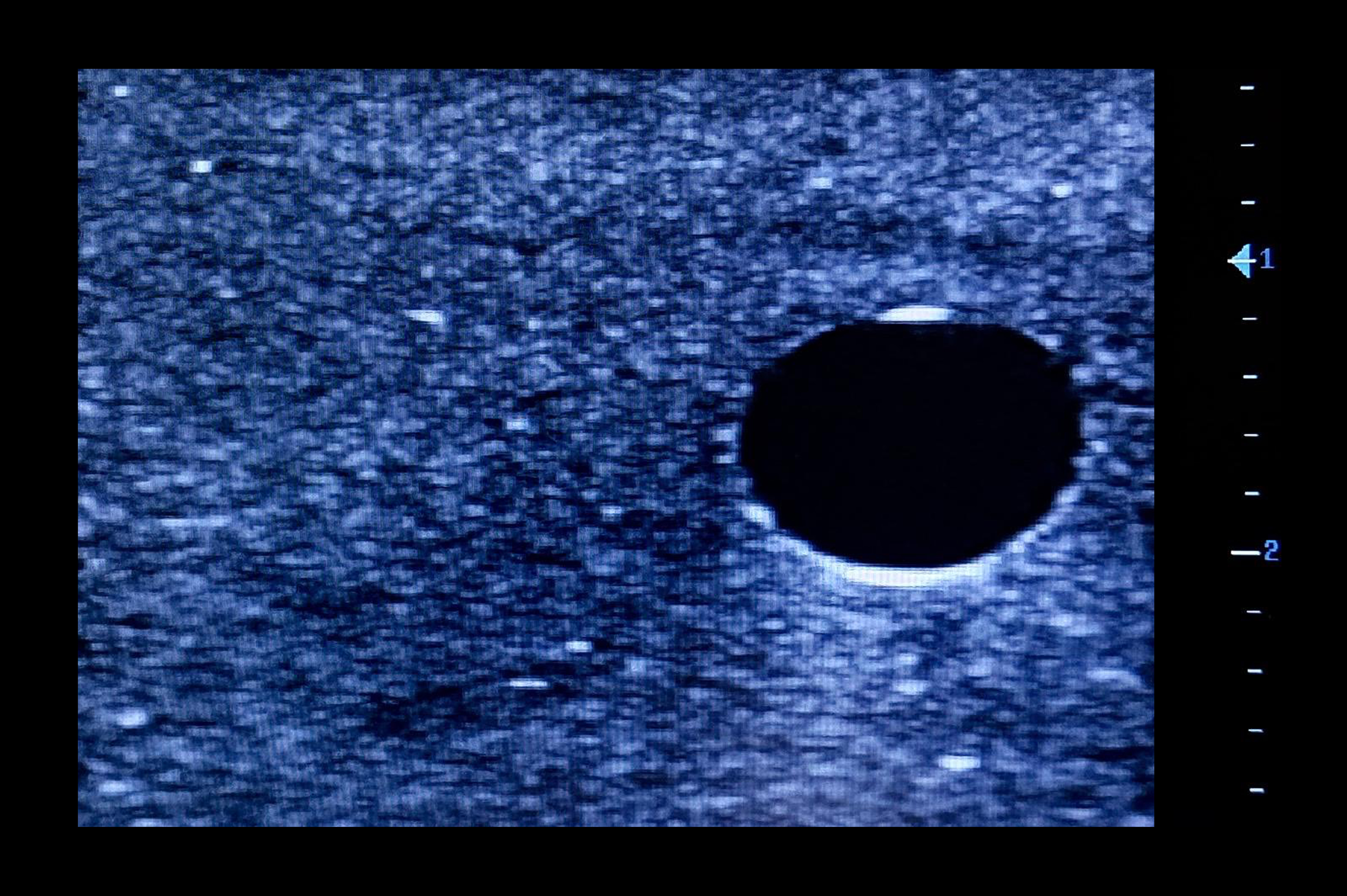 Ultrasound Simulator with 2 Central Lines, Dark