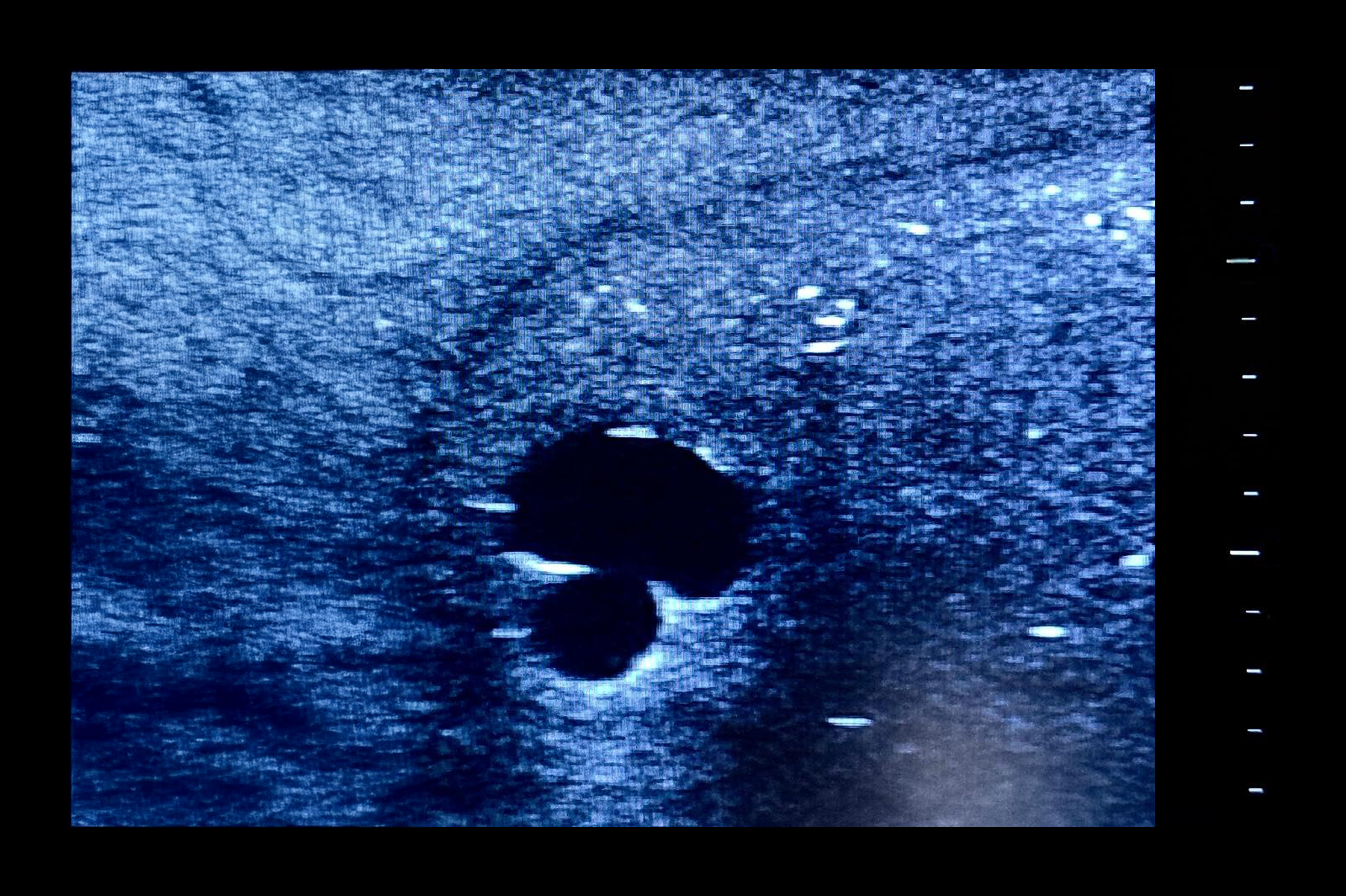 Ultrasound Simulator with 2 Branched Veins, Light