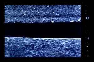 Ultrasound Simulator with 2 Femoral Access Routes, Light