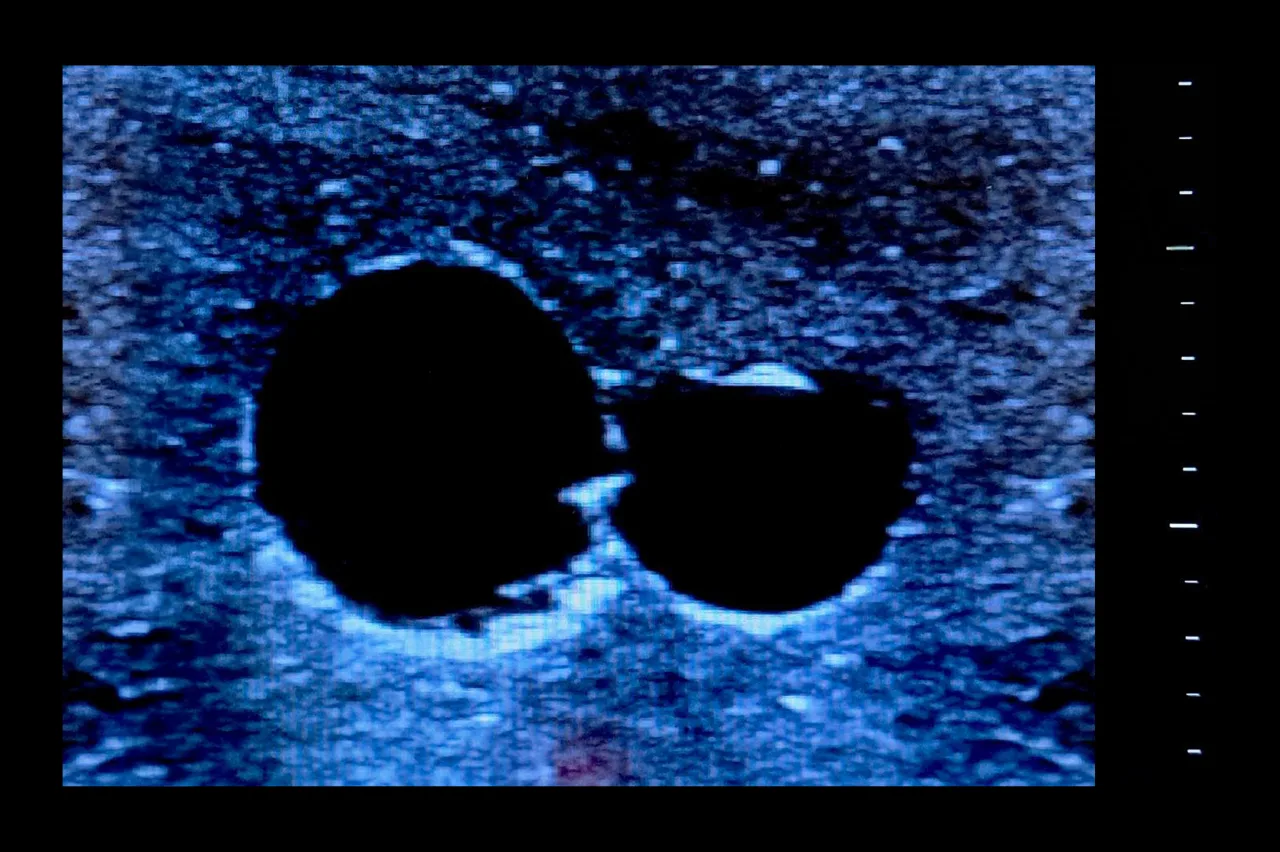Central Access Ultrasound Simulator with Aneurysms, Light