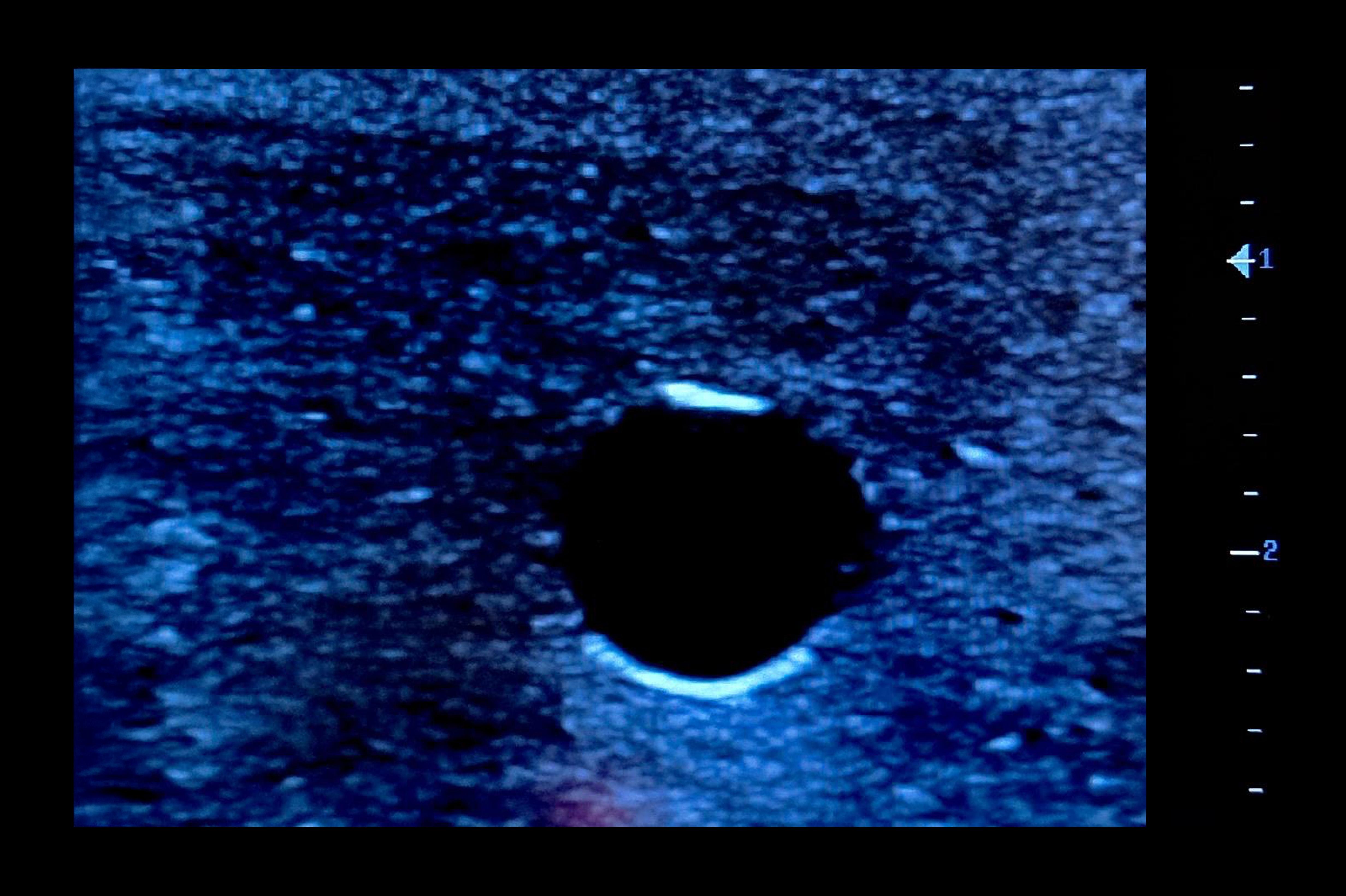 Ultrasound Simulator for PICC Line / Midline/ Seldinger, Dark