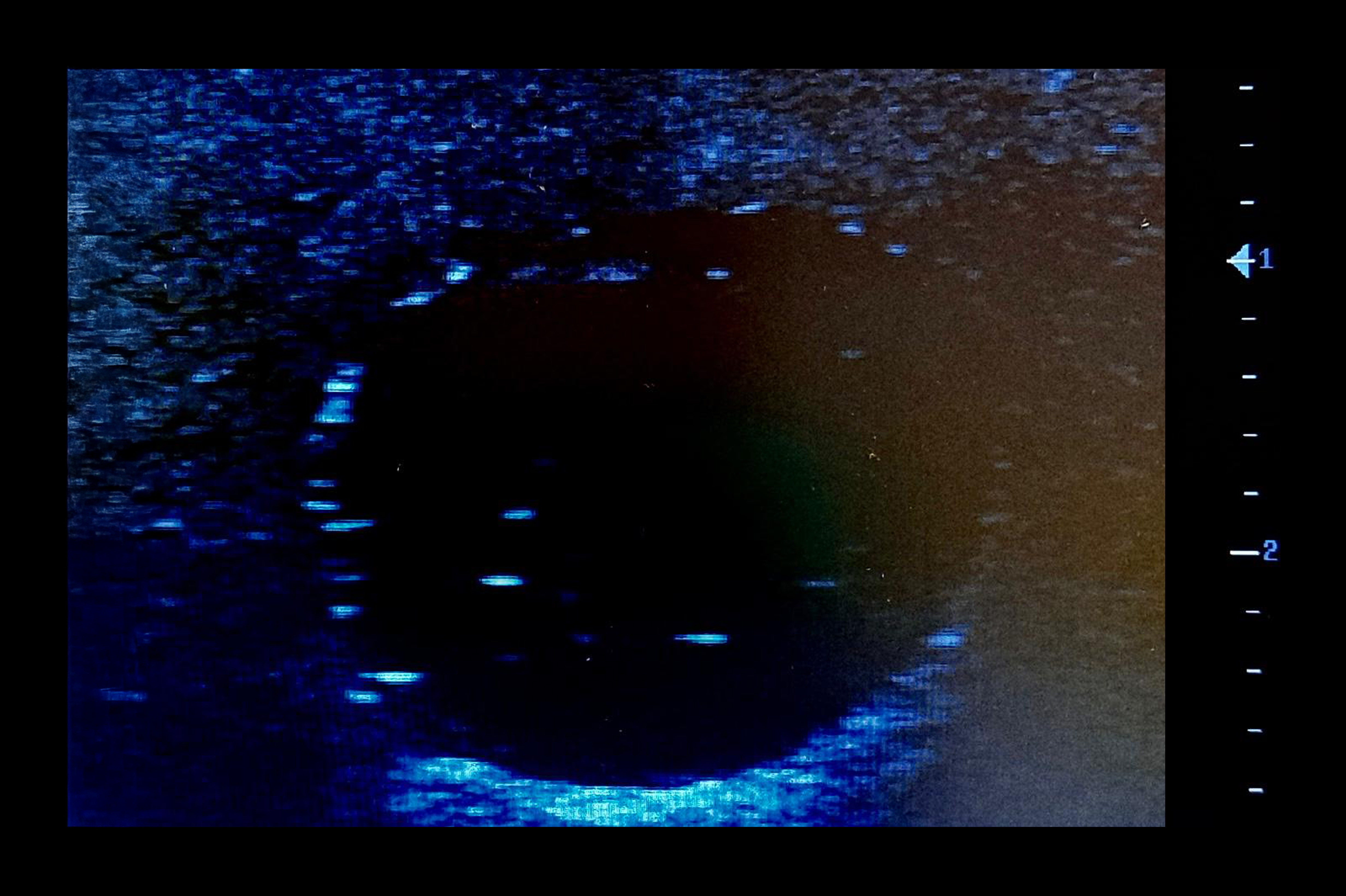 Ultrasound Simulator with Breast Pathologies/Biopsy, Dark