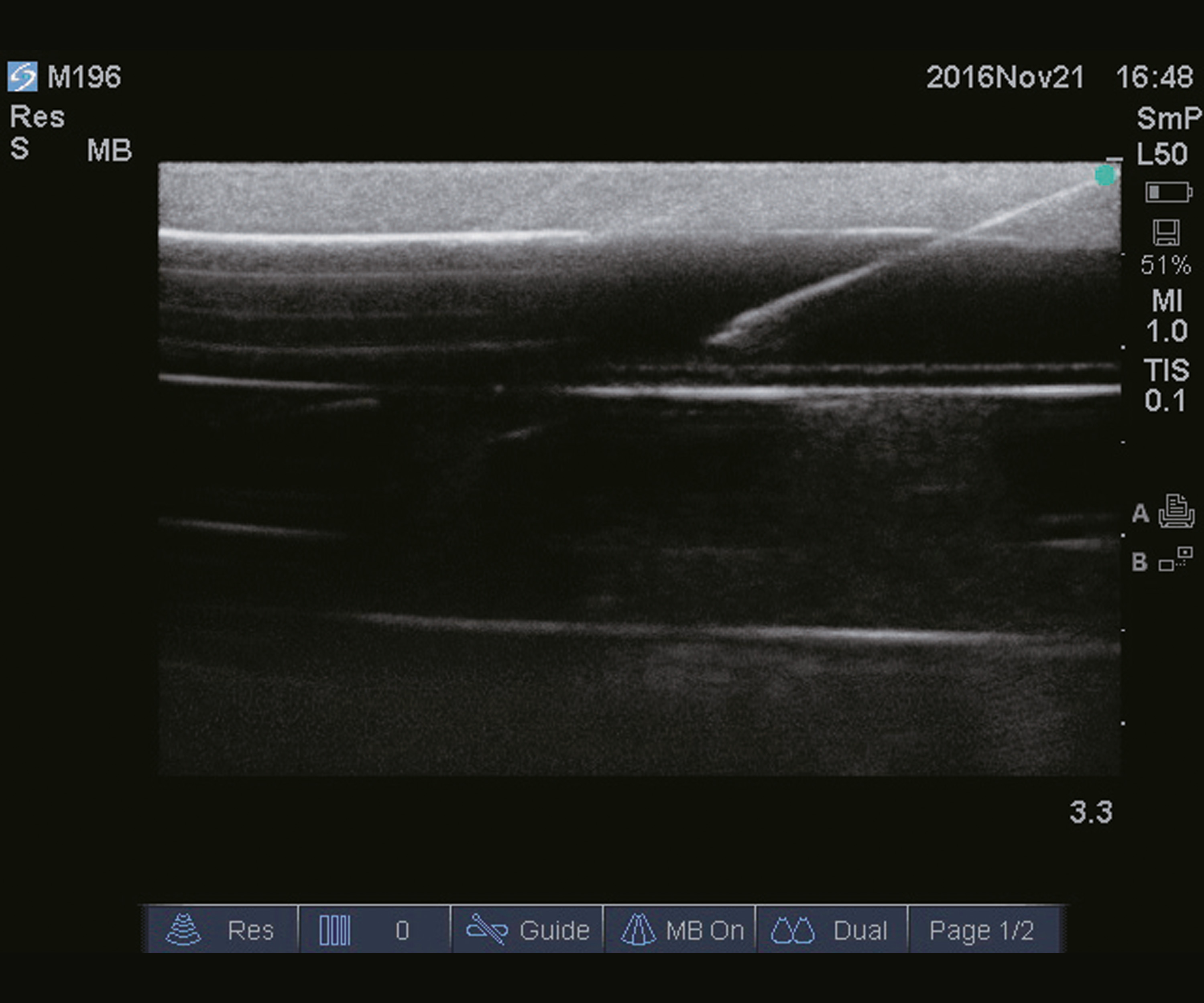 Ultrasound Guide PICC Trainer, Light