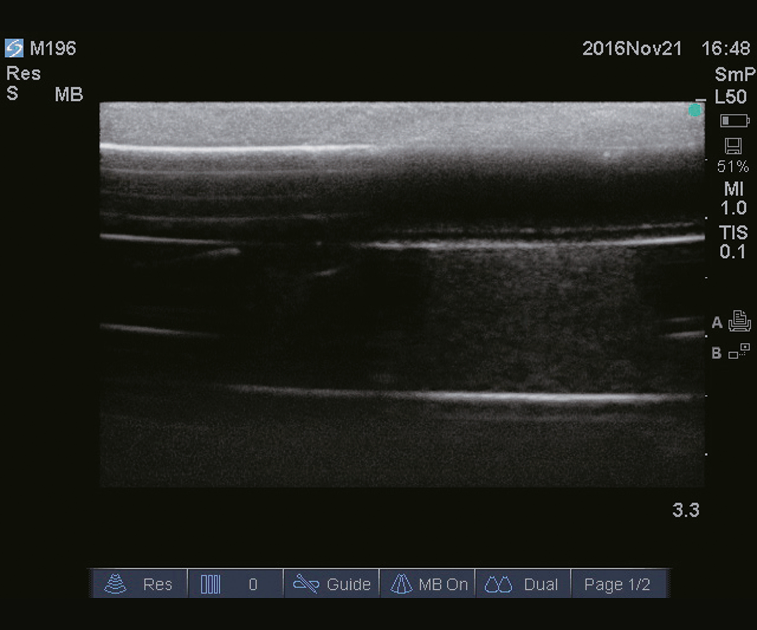Ultrasound Guide PICC Trainer, Light