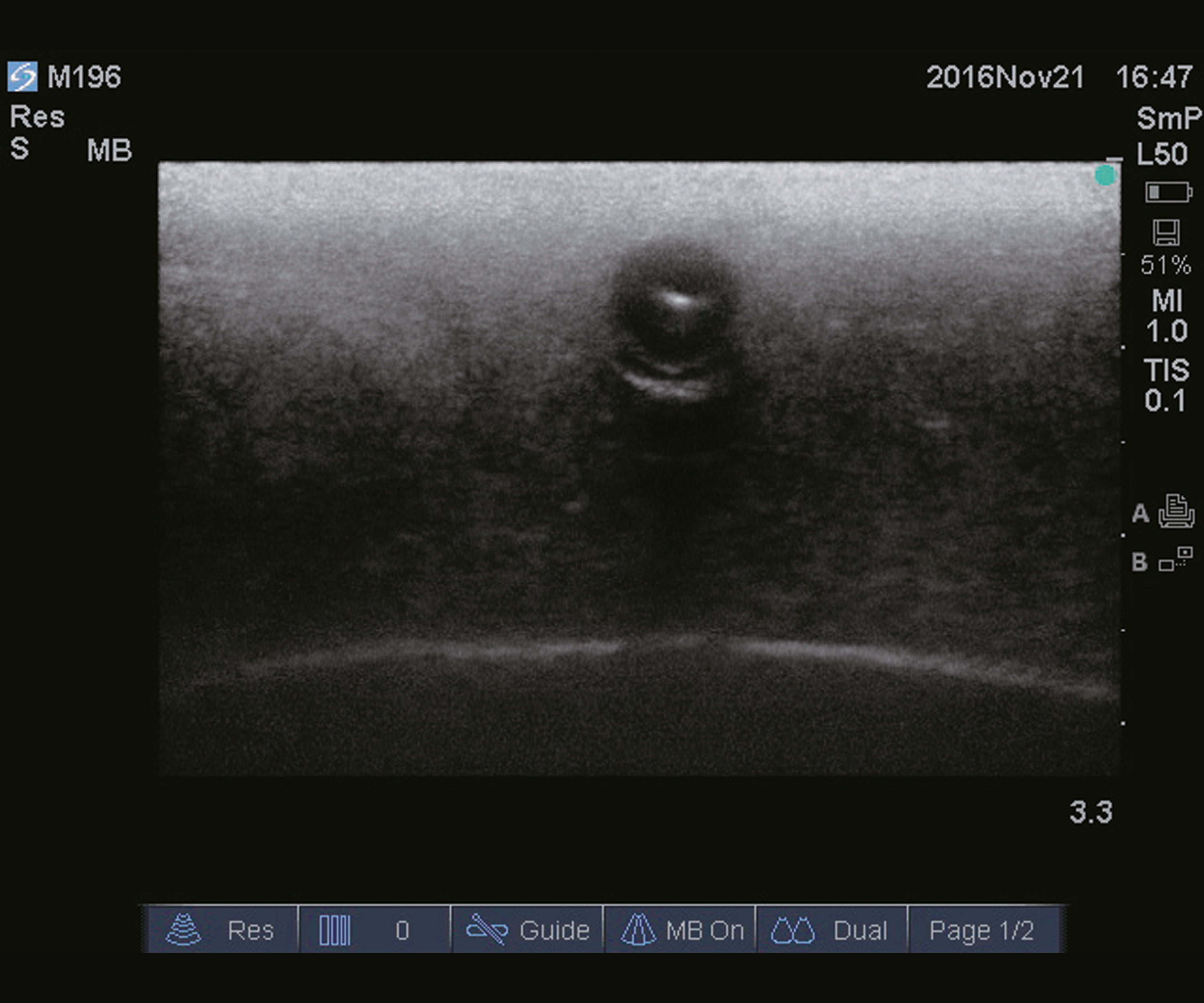 Ultrasound Guide PICC Trainer, Light