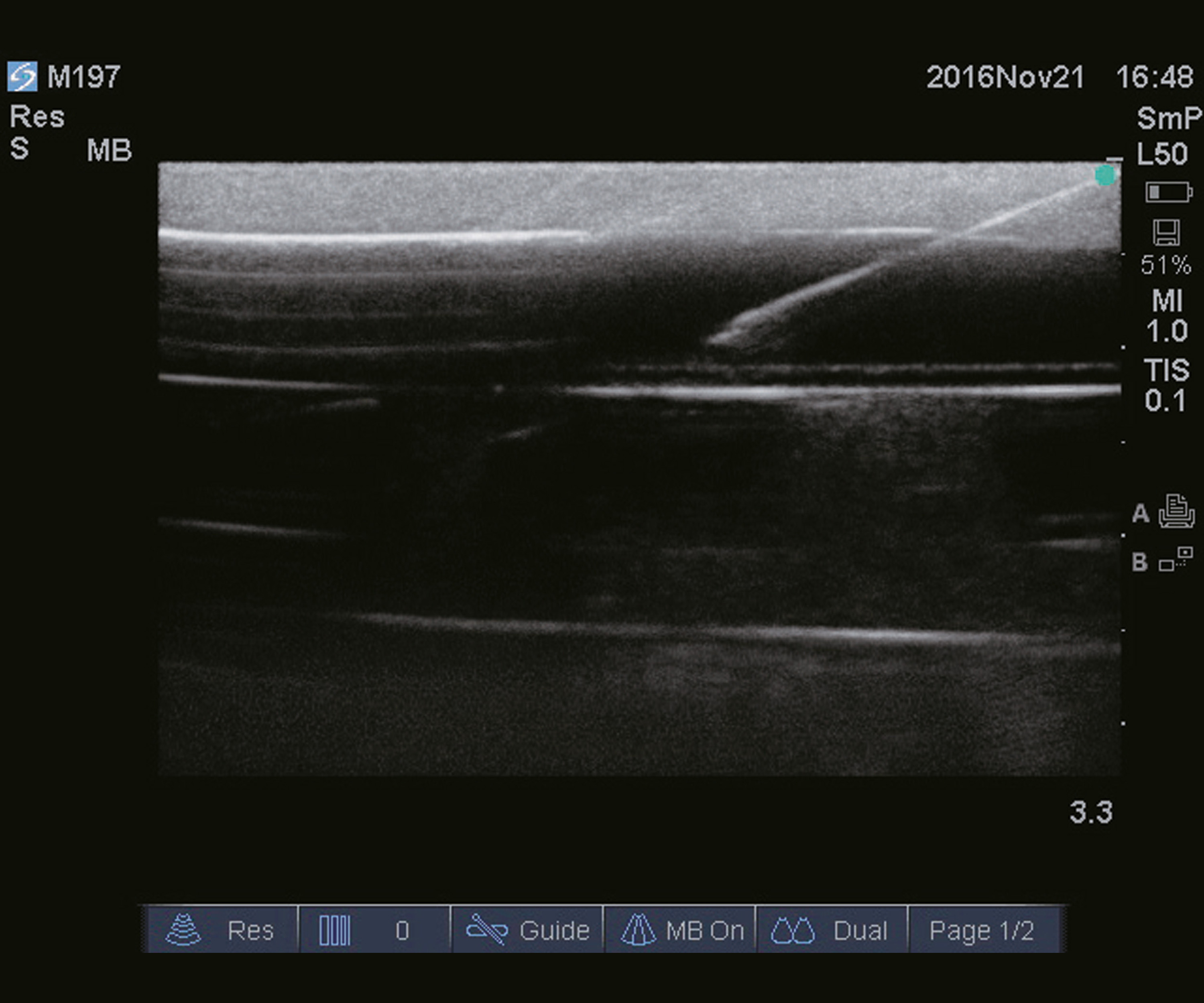 Ultrasound Guide Venipuncture Trainer, Light