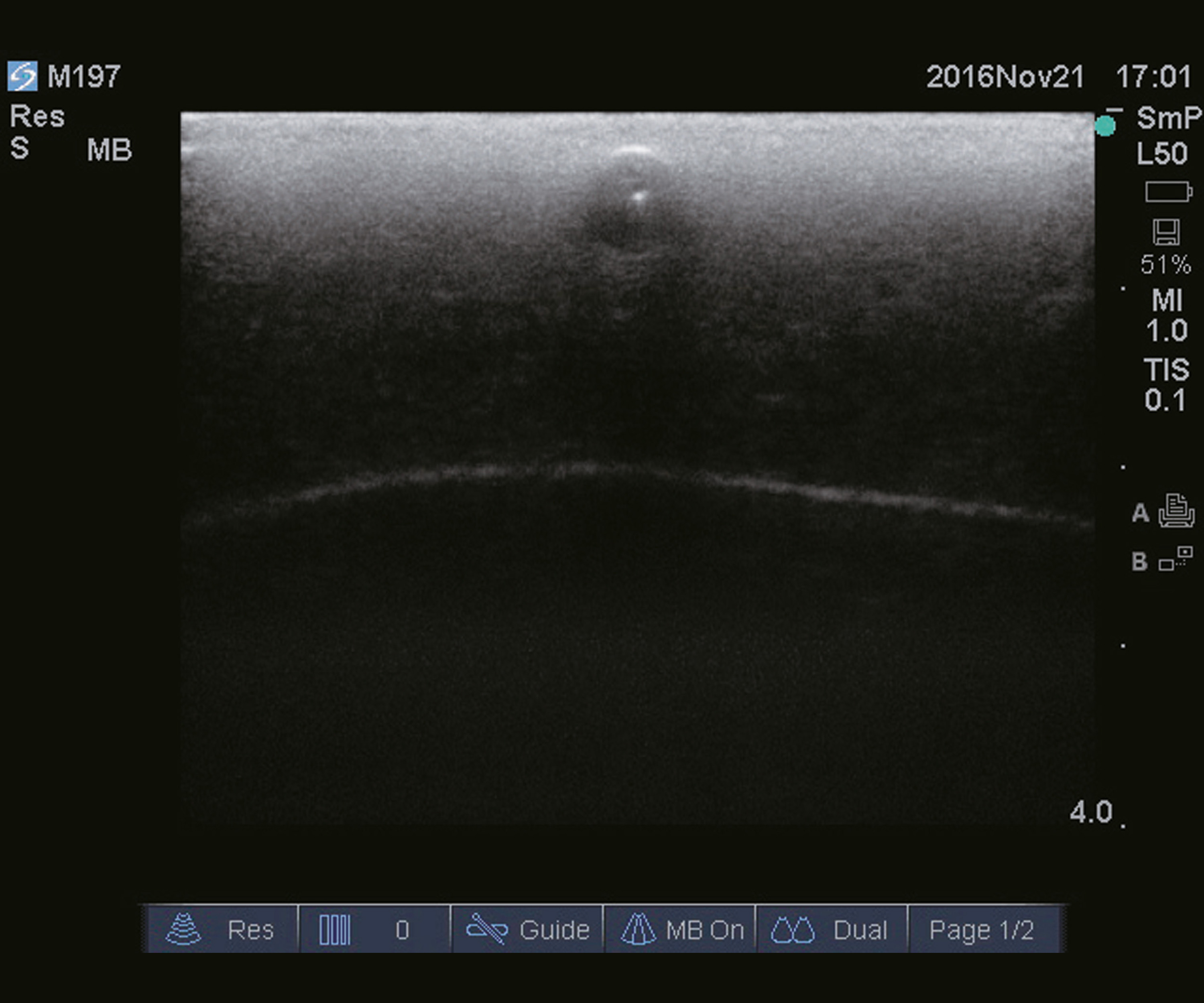 Ultrasound Guide Venipuncture Trainer, Light