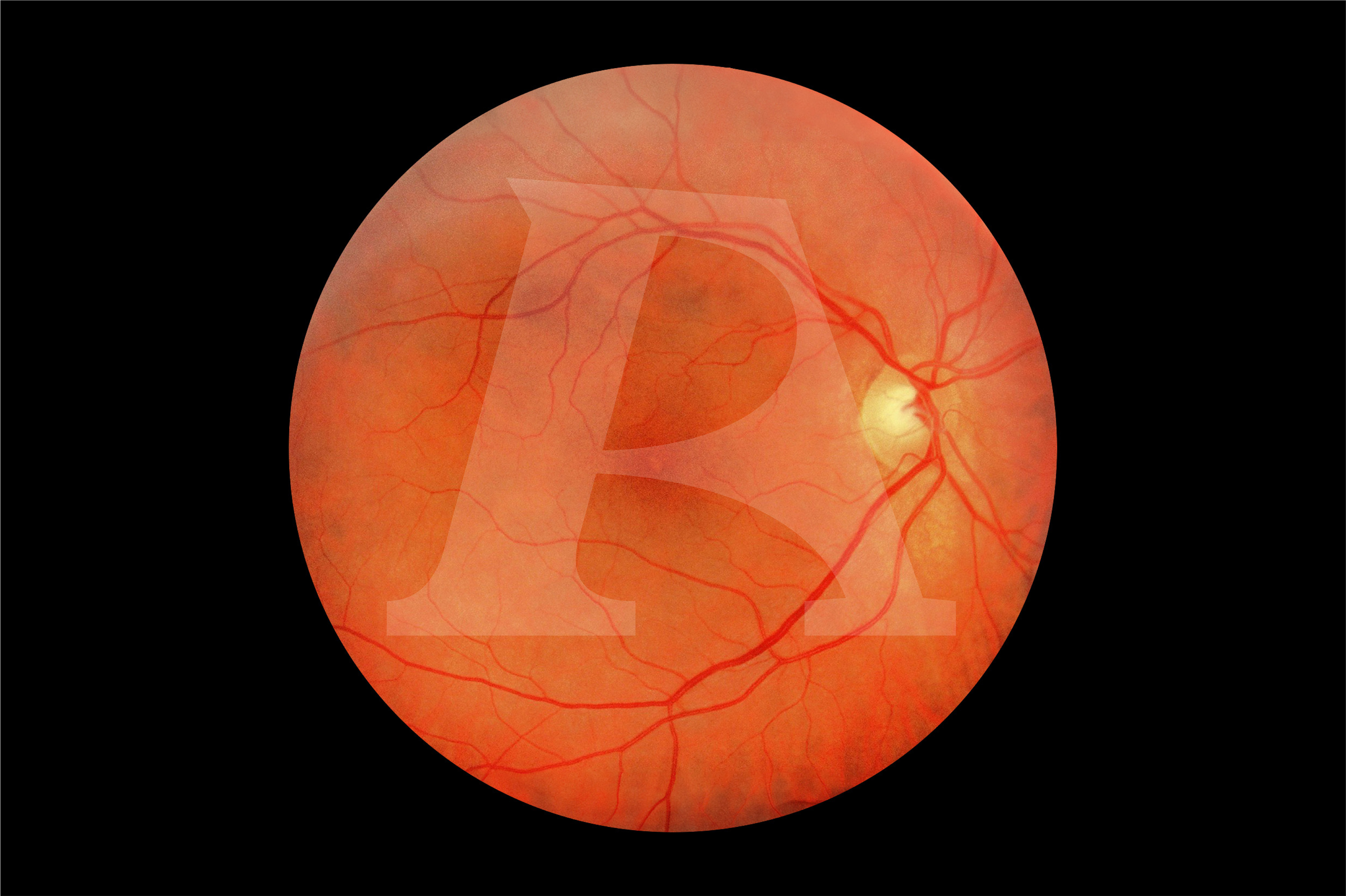 Enhanced Digital Eye Examination/Retinopathy Trainer, Light