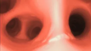 AirSim® Bronchi