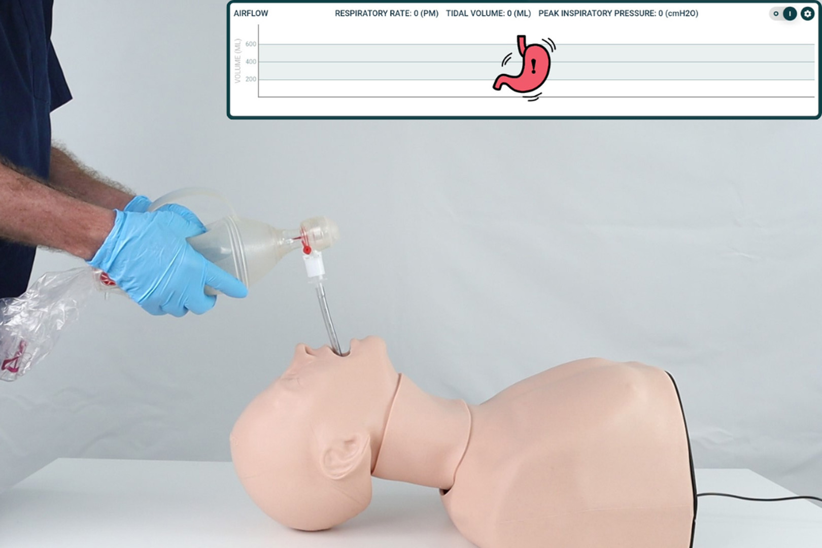 Smart Airway® Adult, Light