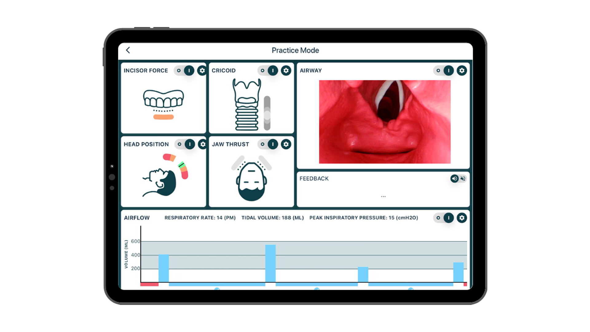 Smart Airway® Adult, Light